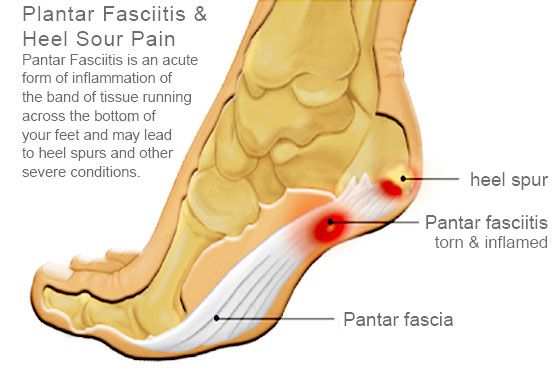 Treatments | All Podiatry Services